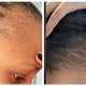 Image for Black Women Are Using This Unusual Male Product to Regrow Their 'Edges'