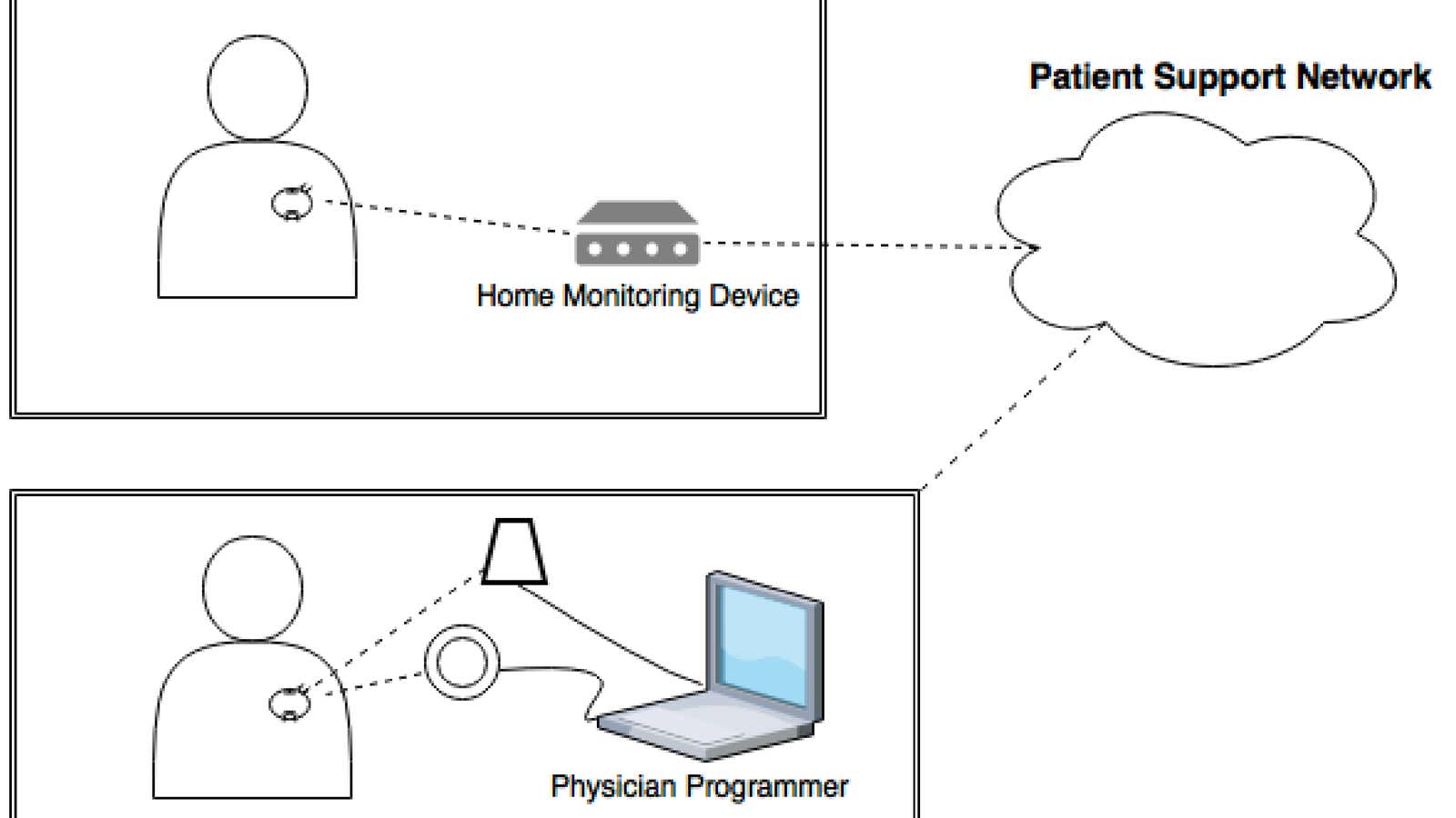 A diagram of typical pacemaker systems