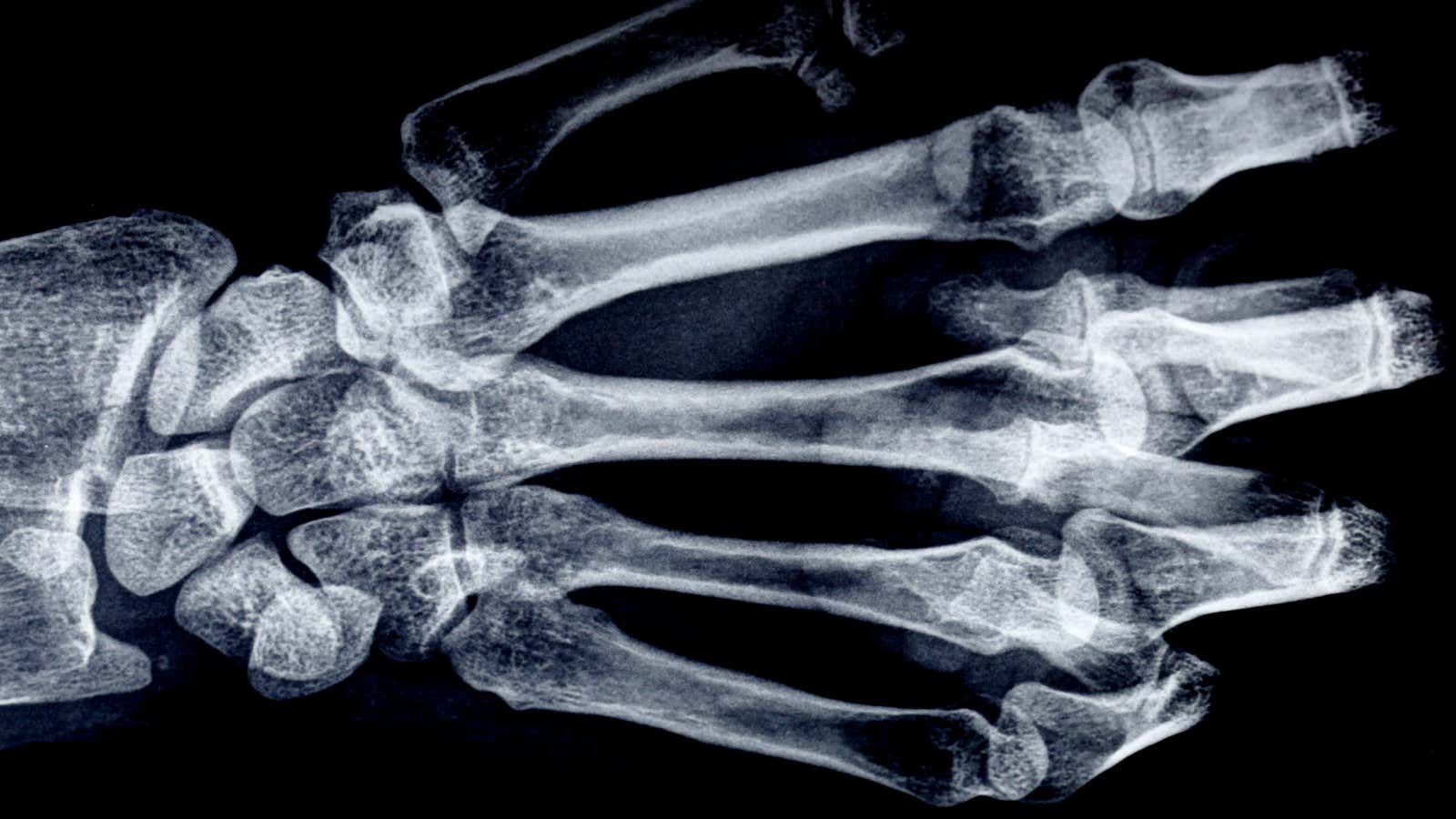 Ever wonder what your bones look like? You’re not alone.