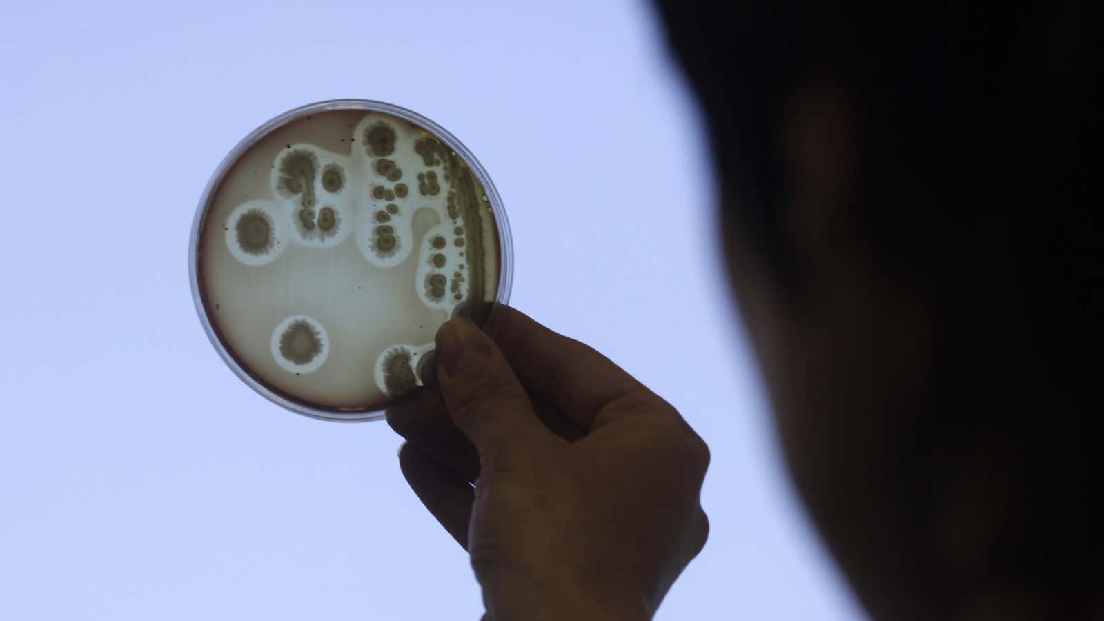 Specialist Jelena Kovalkova looks at a petri dish as she works to isolate the Escherichia coli (E.coli) bacteria strain at the Institute of Food Safety, Animal Health and Environment in Riga June 9, 2011.  More than 1,600 people have been infected by a toxic strain of E.coli bacteria that has killed at least 17 and may be the deadliest yet in human history. Latvian government officials on Thursday informed media of stringent monitoring and control over its food sources, and the country has yet to be hit with any E.coli related cases. REUTERS/Ints Kalnins (LATVIA – Tags: ENVIRONMENT HEALTH SCI TECH)