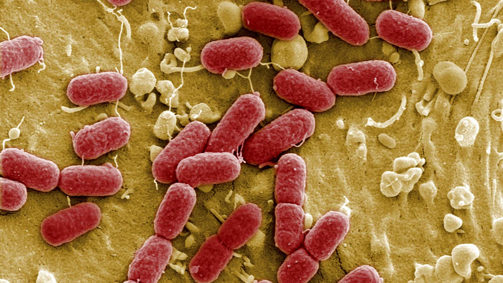 A strain of E-coli bacteria.