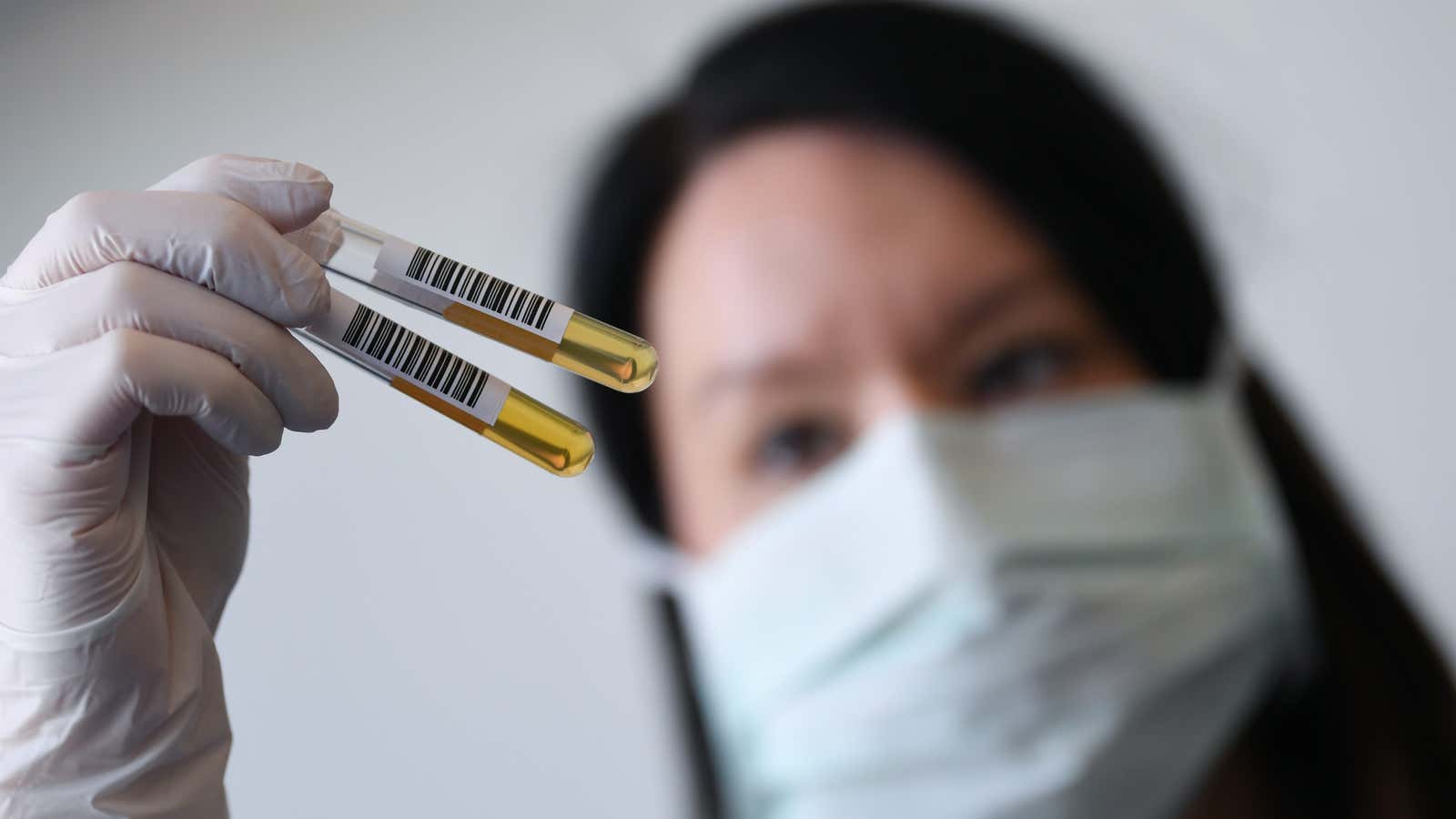 A German researcher checks plasma collected from a recovered Covid-19 patient. Plasma is still a bottleneck for some pharmaceutical companies working on antibody-based drugs.