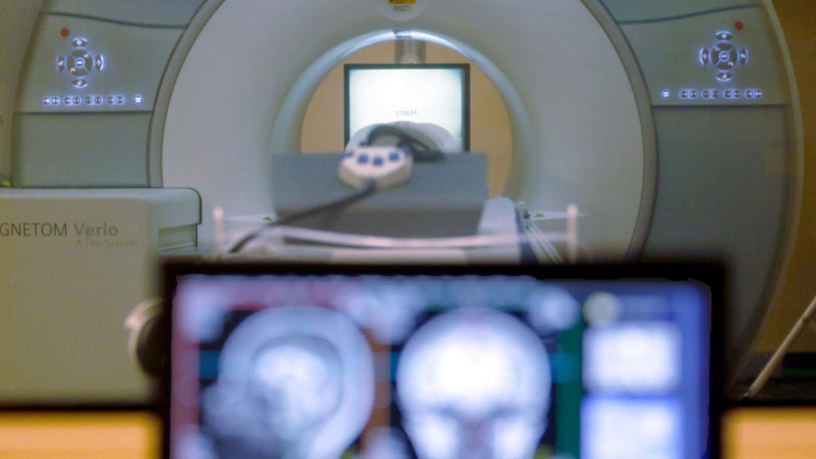 Facebook’s project could make MRIs more efficient.