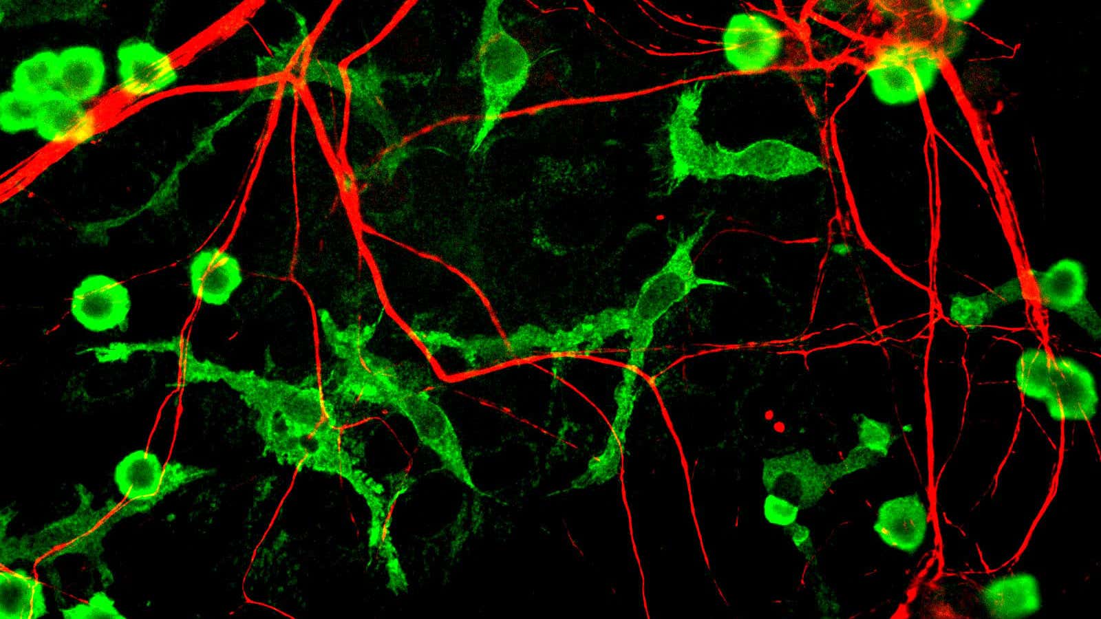 Microglia cells, in green, work by pruning weak connections in the brain.