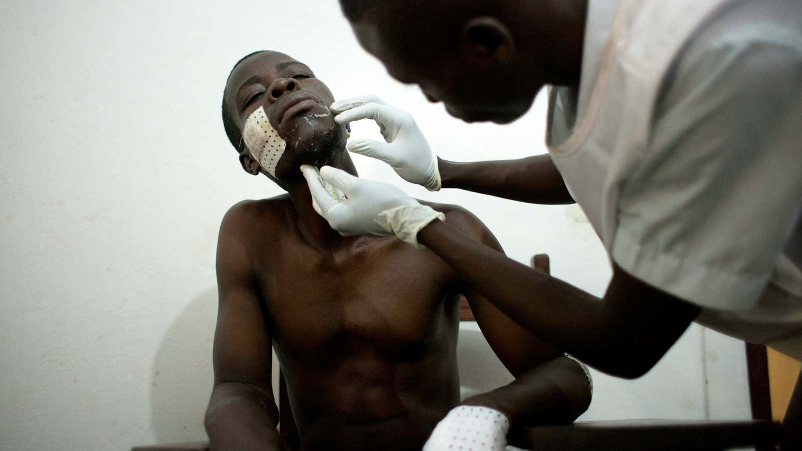 A medical worker changes the bandages of a young man who survived a machete attack, at a Doctors Without Borders clinic in a camp for…