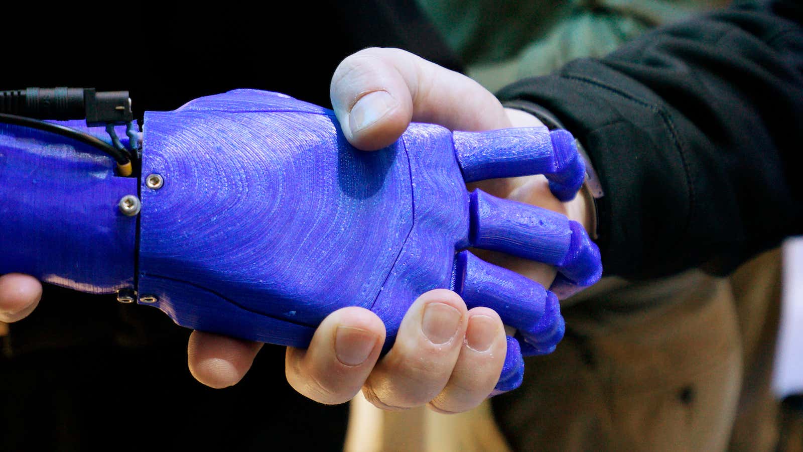 Modern prosthetics go beyond bionic limbs—and into the brain