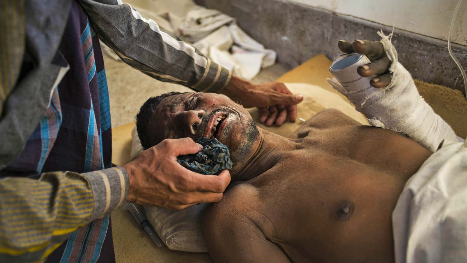 One of the workers injured in the factory collapse is cared for at the Khulna Medical Hospital.