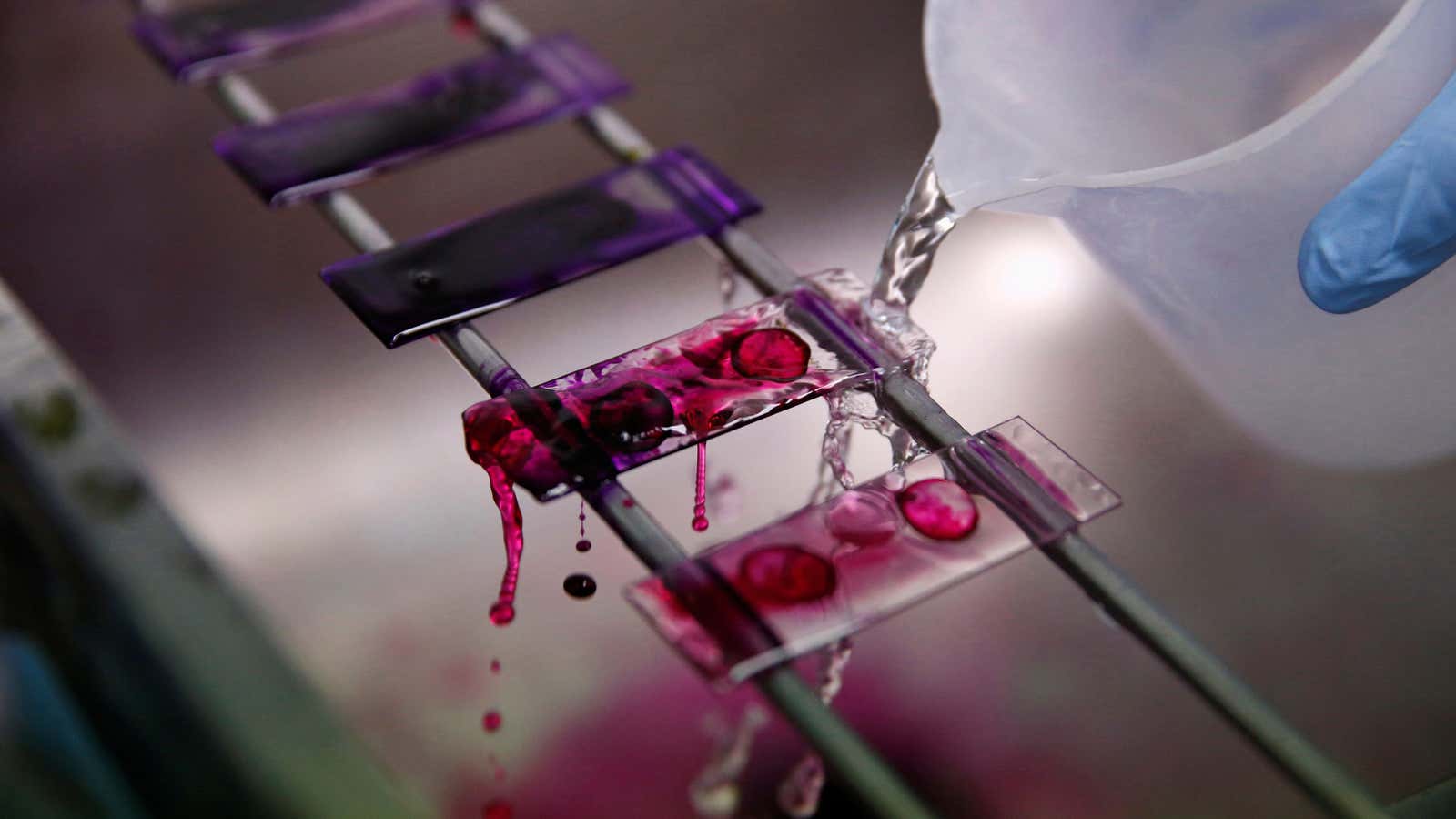 A health technician analyses blood samples for tuberculosis testing in a high-tech tuberculosis lab in Carabayllo in Lima, Peru May 19, 2016. REUTERS/Mariana Bazo