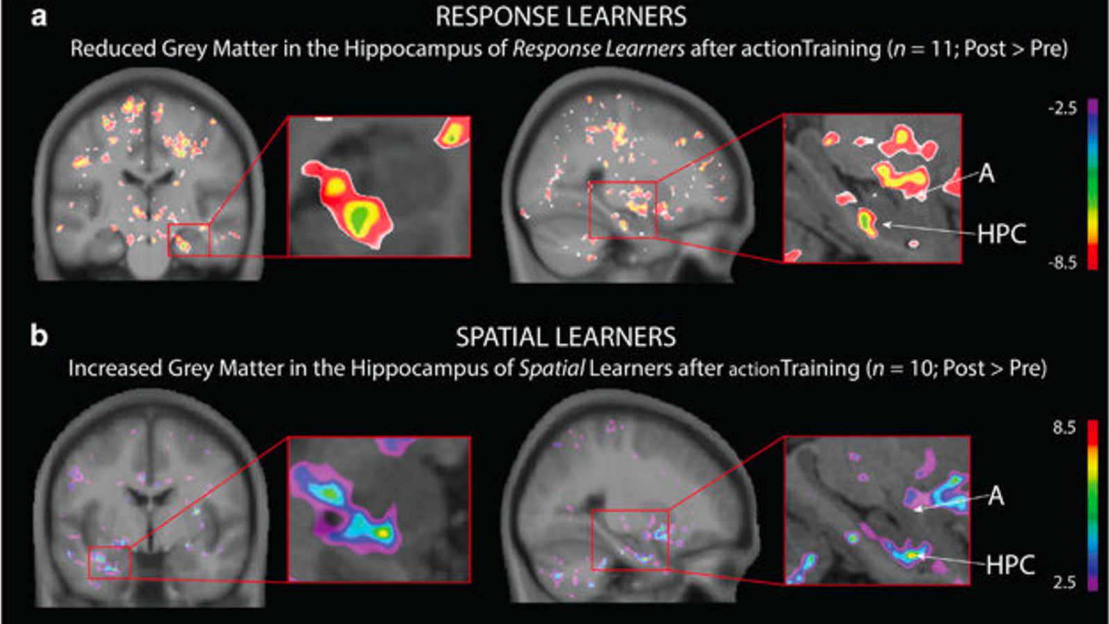 Video games can either grow or shrink part of your brain, depending on how  you play