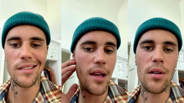 Three images from Justin Bieber's June 10th announcement that show half of his face paralyzed.