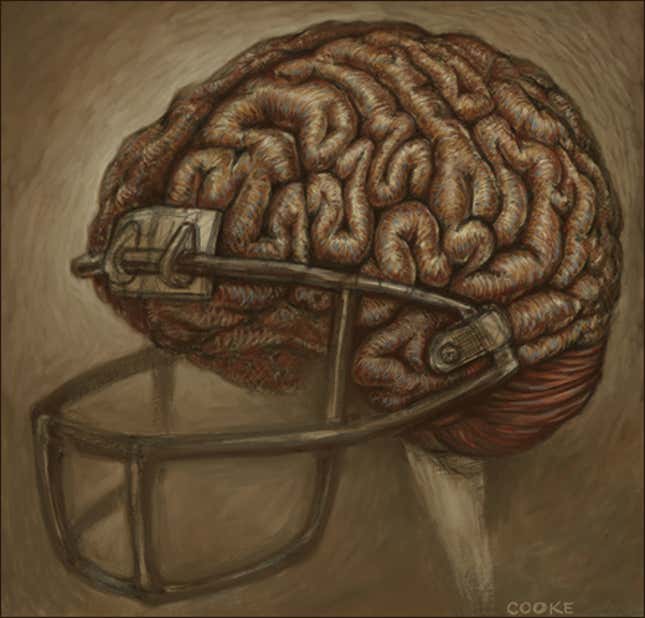 Image for article titled Friday Night Blight: Why High School Football Is Ground Zero Of The Concussion Crisis
