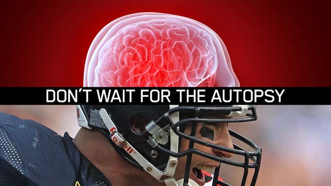 Image for article titled Study Says It Can Track NFL Brain Injuries with PET Scans