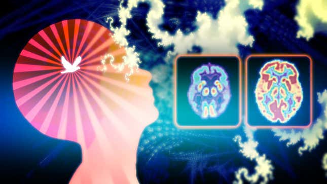 Image for article titled What Happens to the Brain When You Meditate