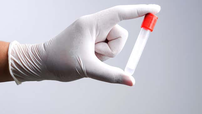 Image for article titled Things No One Tells You About Being A Sperm Donor