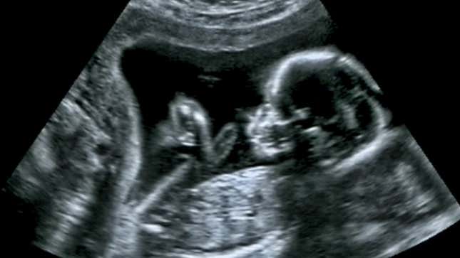 Image for article titled Georgians Explain Why They Are Voting For Herschel Walker
