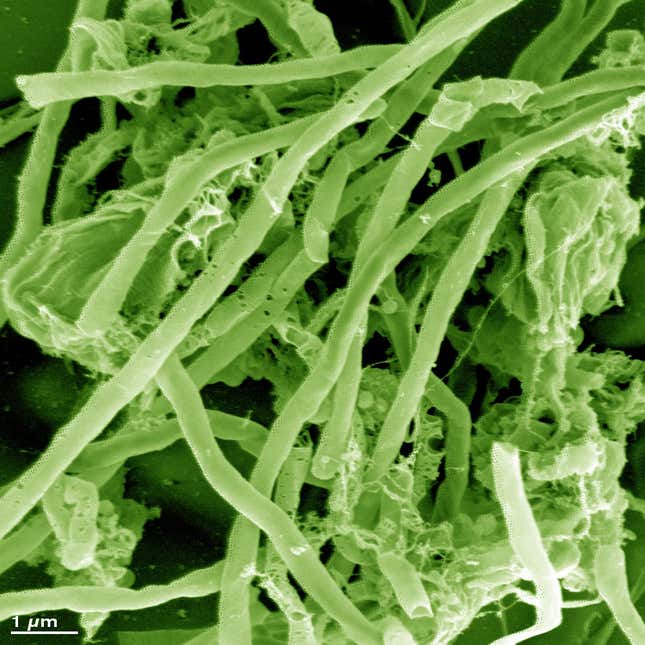 Specially bred and cultured archaea.