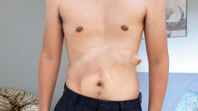 Image for article titled Doctors Successfully Transplant Entire Living Pig Into Patient