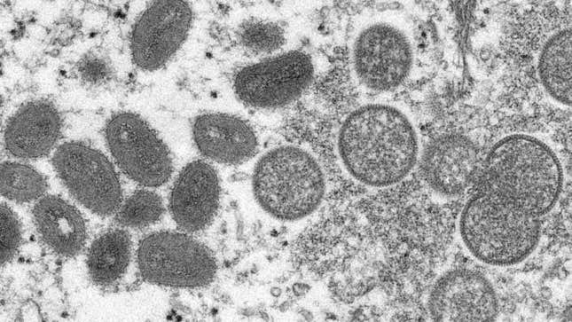 Imagen de microscopio electrónico de partículas virales de viruela de los monos.