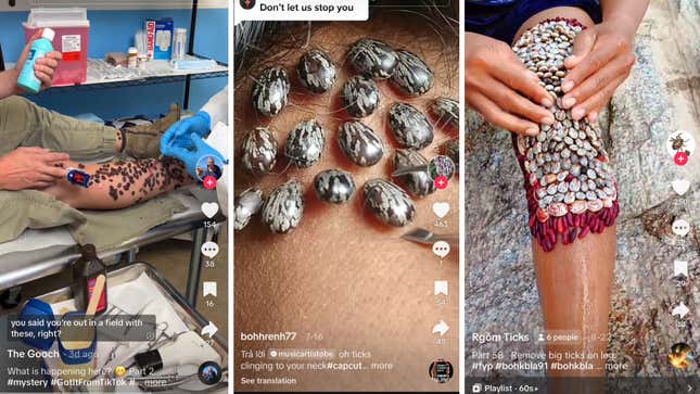 TikTok screenshots: a man at the doctor's with black lumps on his leg; a close-up of streaky gray lumps on a person's neck; a cluster of gray and red lumps on someone's knee that they are trying to pull off.