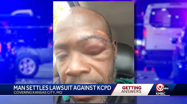 Image for article titled Lying Ass Kansas City Cops Just Got Caught