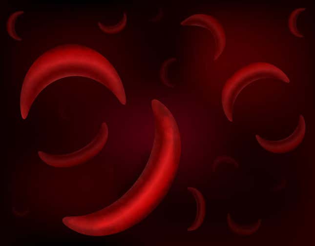 A sickle-like shape prevents the red blood cell from doing its job.
