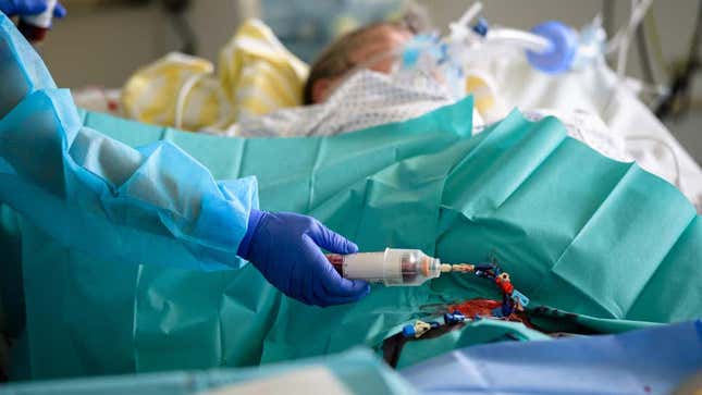 Un médico atiende a un paciente en la unidad de cuidados intensivos covid-19 en el Hospital Universitario de Leipzig el 18 de noviembre de 2021 en Leipzig, Alemania