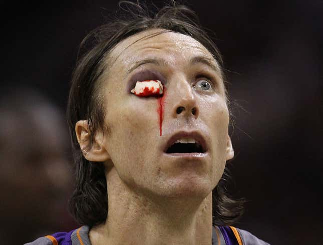 Image for article titled Injured Steve Nash Finishes Game With Cotton Stuffed In Eye Socket