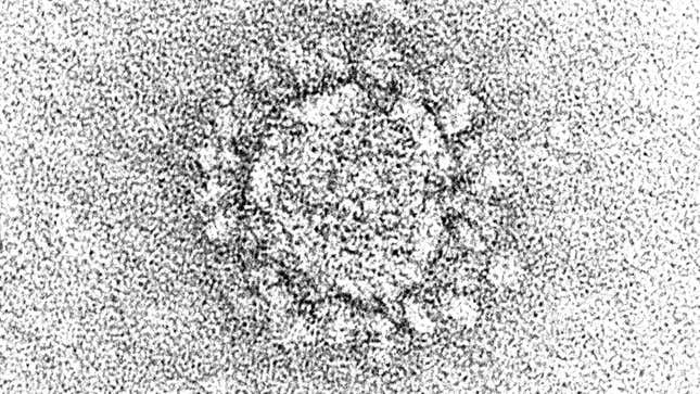 An electron microscopic image of a negatively stained particle of SARS-CoV-2.