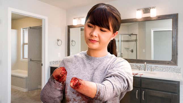 Image for article titled Woman’s Hands Become Bloody Nubs Of Raw Flesh After Forgetting Nightly Moisturizing Routine