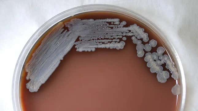 A photo of Burkholderia pseudomallei cultured in chocolate agar after three days time