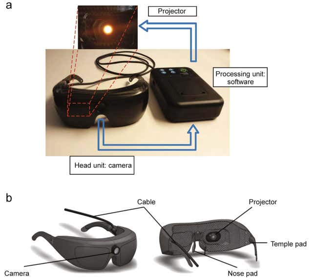 Estas gafas especializadas captan información del mundo exterior y la traducen en pulsos de luz ámbar destinados a ayudar a las retinas editadas genéticamente a percibir la información de forma similar a como lo hace la retina en personas sin estos trastornos genéticos.