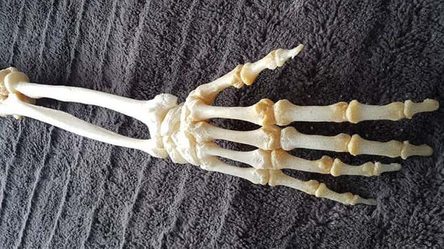Imagen para el artículo titulado Le amputan un brazo y encarga su conservación a un taxidermista para guardarlo como adorno