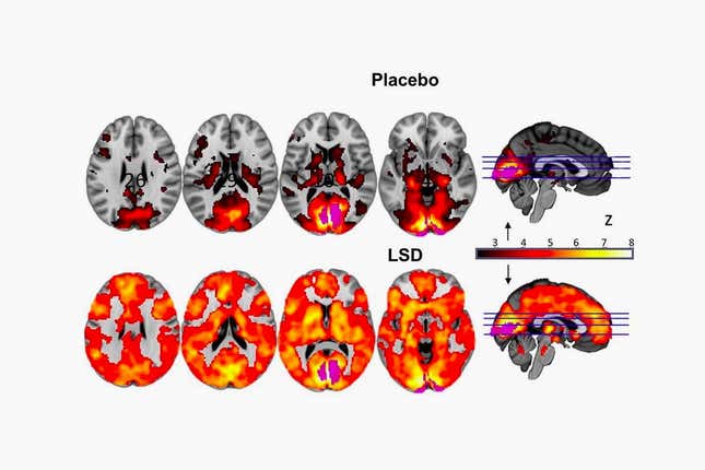 Image for article titled The first ever scientific study to capture images of your brain on LSD had to be crowdfunded