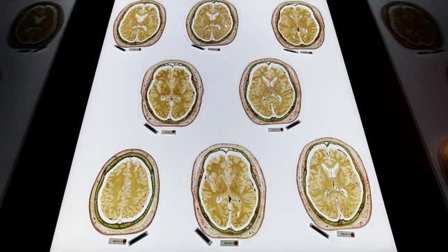 Plastinated slices of the human brain exhibited at the Plastinarium, a museum, teaching center, and body preparations facility created by anatomist Gunther von Hagens, in Guben, Germany.