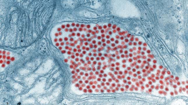 The Eastern equine encephalitis virus (in red) seen magnified in the salivary gland tissue of an infected mosquito.