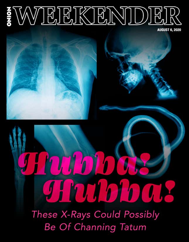 Image for article titled Hubba Hubba! These X-Rays Could Possibly Be Of Channing Tatum