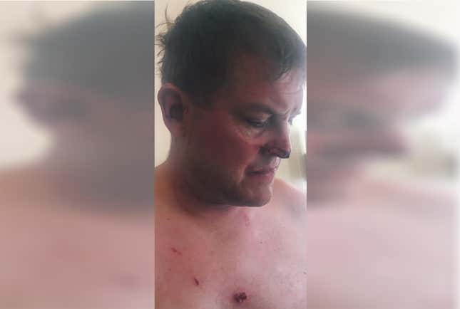 Image for article titled Tourist Accused of Killing Hotel Worker in Anguilla Speaks Out
