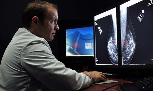 Imagen para el artículo titulado Una nueva IA de Google es capaz de revelar cáncer de mama que los expertos no detectan