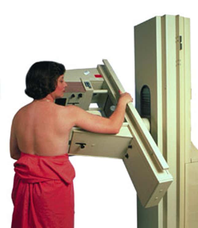 Image for article titled Mammograms