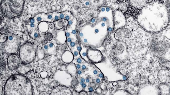 Microscopic image of SARS-CoV-2, the virus that causes covid-19 (highlighted in blue). 