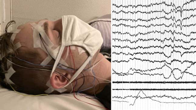 Electrical signals from a sleeping person’s brain are shown on the monitor.