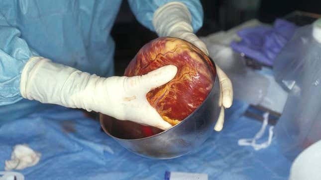 Image for article titled Insurance Only Covers Generic Heart Transplant