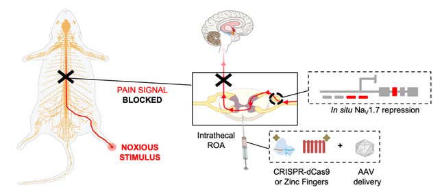 A visual illustration of how the team’s gene therapy is supposed to help suppress chronic pain.