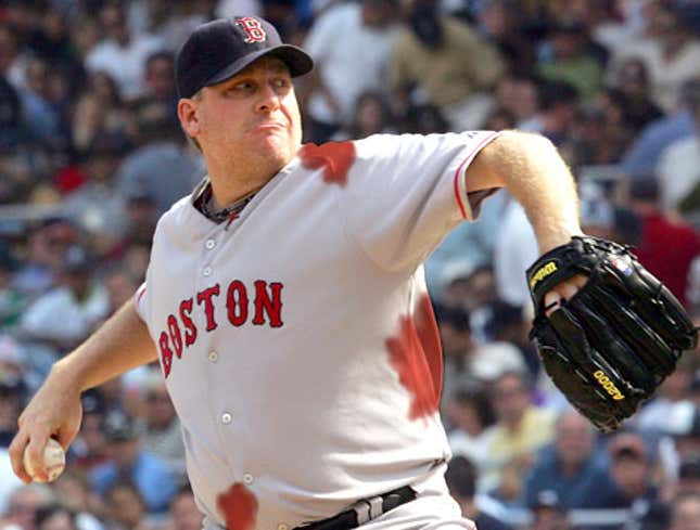 Image for article titled Curt Schilling Inexplicably Bleeding Throughout Game 3 Start