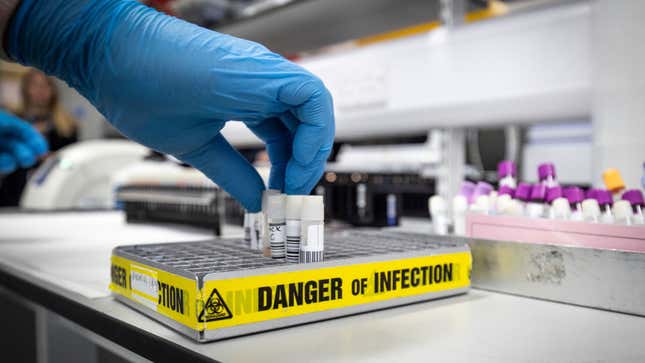 Un técnico de laboratorio extrae virus de muestras en el laboratorio de pruebas de coronavirus en Glasgow Royal Infirmary en Escocia, tomada el 19 de febrero de 2020.