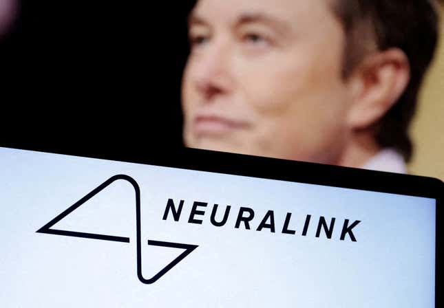 Image for article titled 🌏 Neuralink is being probed