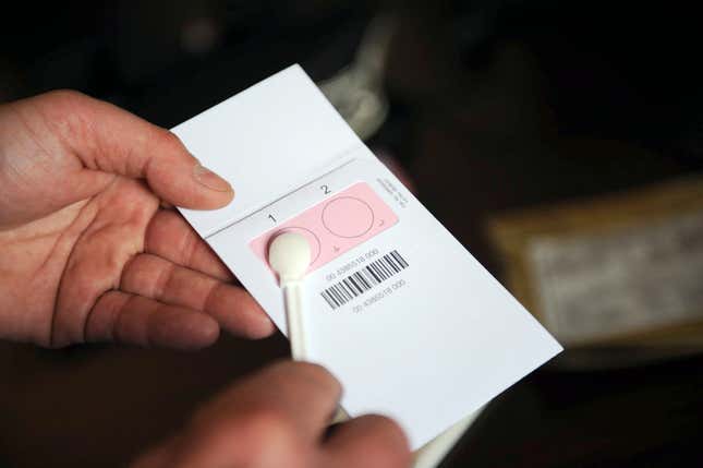Image for article titled San Francisco Police Will Stop Using Rape Kits As Evidence Against Rape Victims