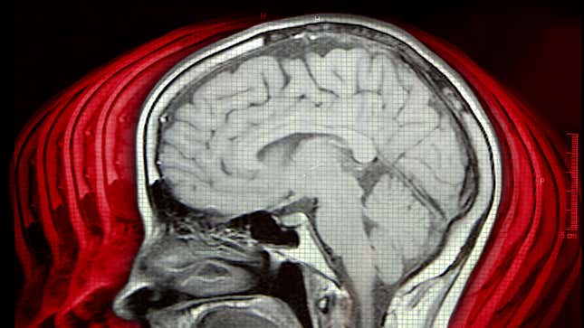 My 100 Concussions: Notes From A Terrified CTE Study Participant