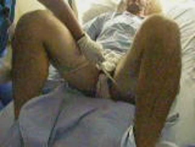 We Have A Winner: The Grossest Story You'll Ever Read