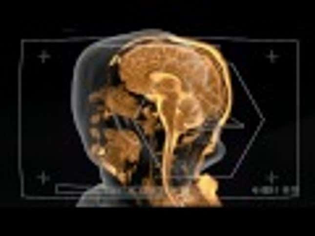 Brains Are Weird. Let's Look At One Singing And A Different One Forming A Thought.